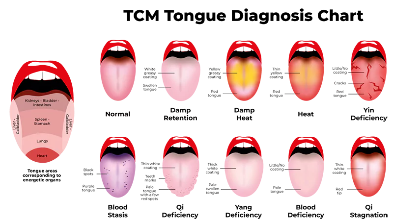 Tongue Diagnosis Chart
